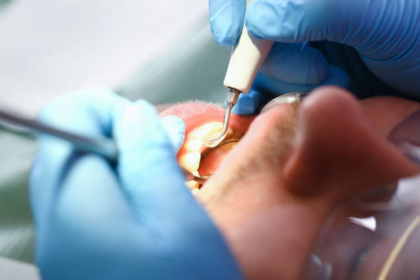 Best Broken or Cracked Tooth Emergency Dentist in Bogota, NJ