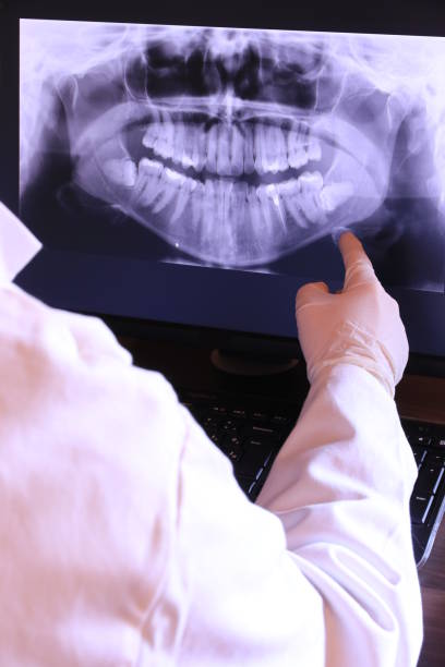 Best Emergency Root Canal Treatment in Bogota, NJ