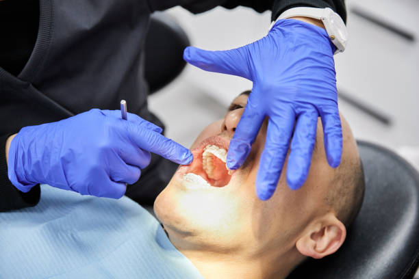 Best Emergency Dentist for Lost Fillings or Crowns in Bogota, NJ