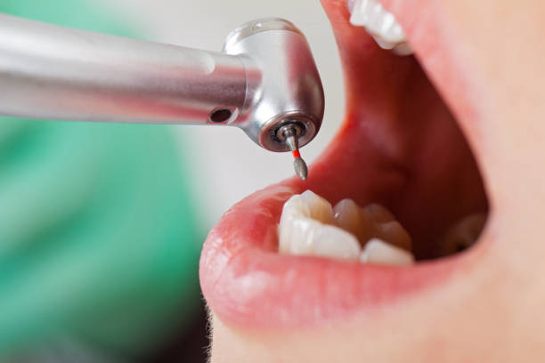 Best Emergency Dentist for Knocked-Out Tooth in Bogota, NJ